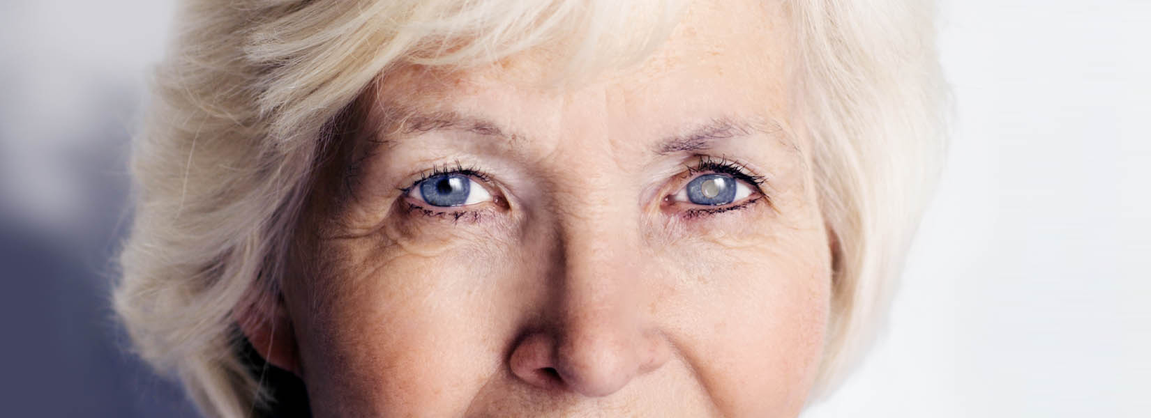 Cataract Surgery in Highlands Ranch